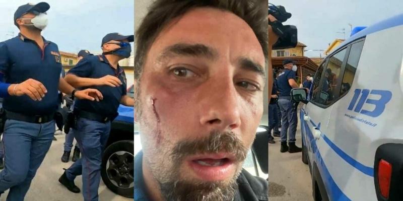 Aggressione a Brumotti, confermati gli arresti: ai domiciliari chi ha sferrato il pugno all'inviato di "Striscia"